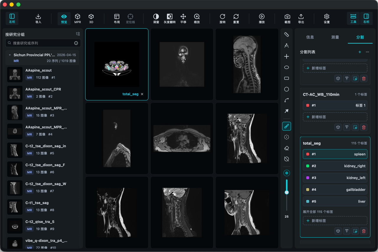 VisoRay multi-viewport DICOM image browsing interface