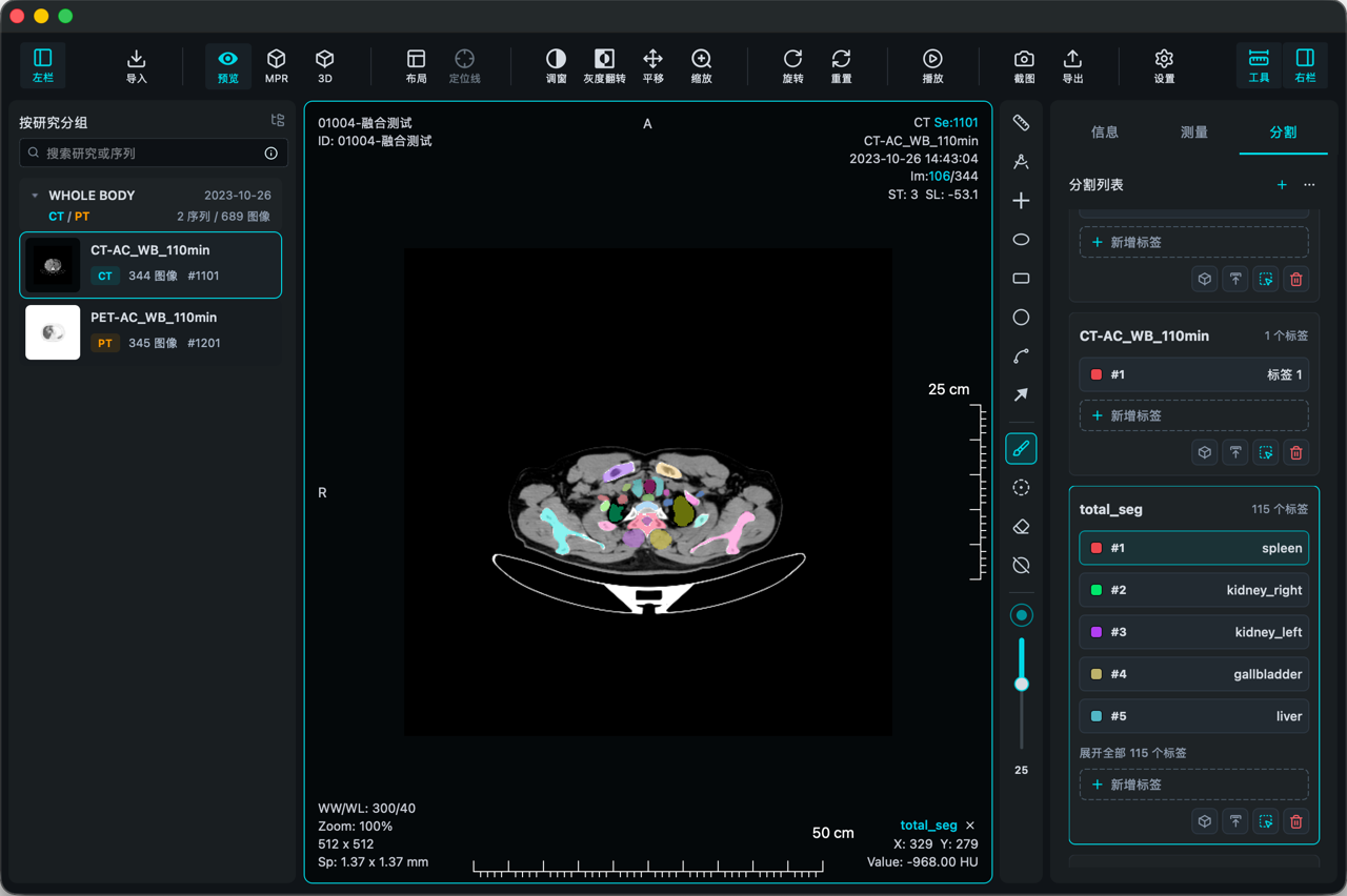 VisoRay segmentation overlay and label management interface